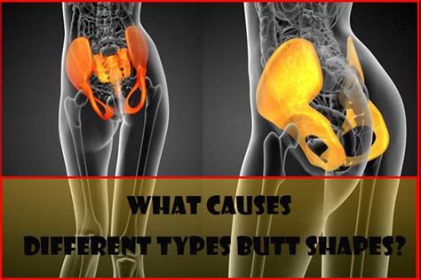 bubbly ass|The 5 Different Types of Butt Shapes, Explained